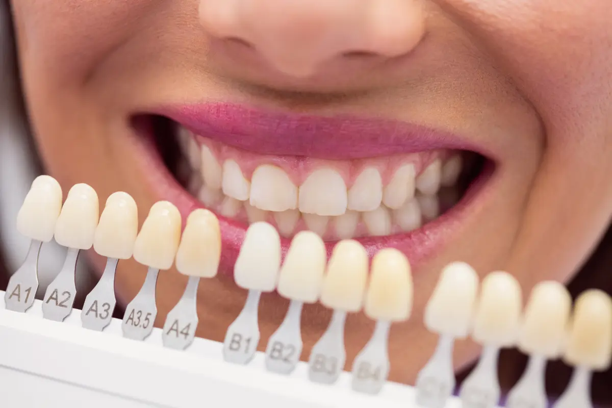 Zahnarztpraxis Angela Kratzer aus Gohrisch – Bleaching Bleaching